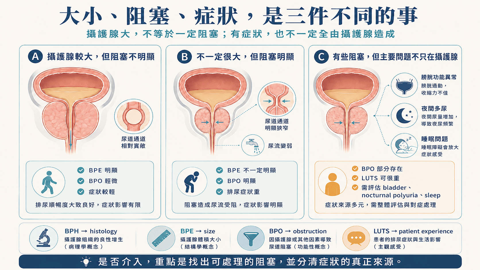 三種攝護腺與症狀情境,包括攝護腺較大但阻塞不明顯、攝護腺不一定很大但阻塞明顯,以及阻塞合併膀胱、夜間多尿或睡眠問題。